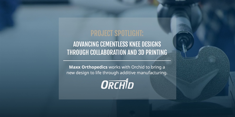 PROJECT SPOTLIGHT: Advancing Cementless Knee Designs through Collaboration and 3D Printing